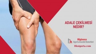Adale Çekilmesi Nedir?