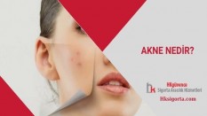 Akne Nedir?