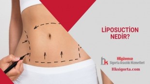 Liposuction Nedir?