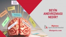 Beyin Anevrizması Nedir?