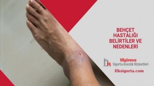 Behçet Hastalığı Belirtiler ve Nedenleri