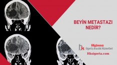 Beyin Metastazı Nedir ve Belirtileri
