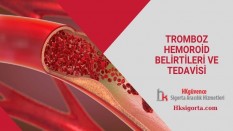 Tromboz Hemoroid Belirtileri ve Tedavisi